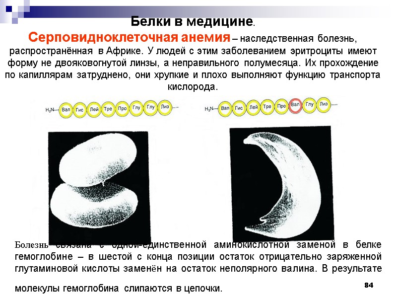 84 Белки в медицине. Серповидноклеточная анемия – наследственная болезнь, распространённая в Африке. У людей